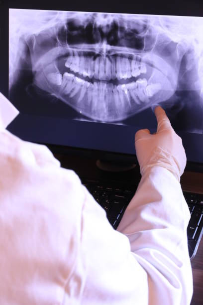 Best Emergency Tooth Extraction in Sundown, TX