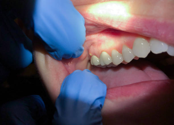 Best Emergency TMJ Treatment in Sundown, TX