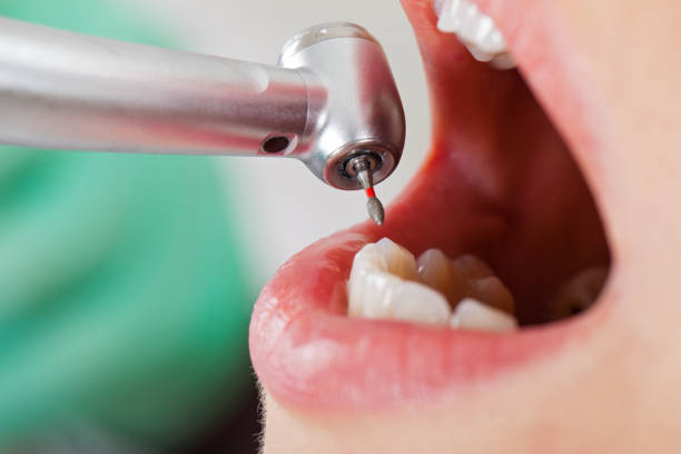 Best Emergency Treatment for Dental Infections or Abscesses in Sundown, TX